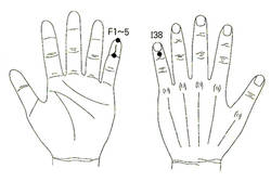서금요법(서암뜸)지상강좌(4)