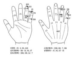 임상사례(2)-류머티스관절염