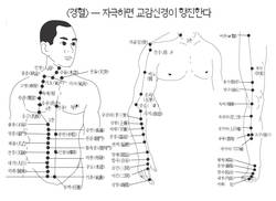 "체침시술 이대론 안된다"