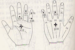 서금요법 지상강좌(30)