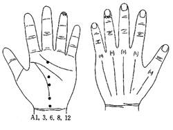 학술위원 서금요법(32)