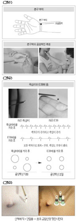 기획연재/ 신체에 뜸을 떠서는 안되는 이유 1