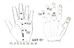 지상강좌(49) 갑상선종대