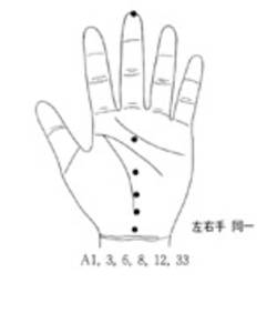 학술위원 지상강좌(50)-대머리 시술