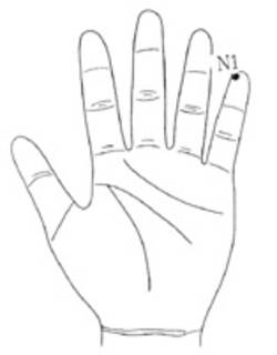 학술위원 지상강좌-엄지발가락에 종기