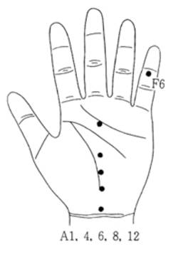 학술위원 지상강좌-주부습진