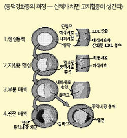 최신온열요법(10)서암뜸 노화방지에 효과좋아