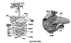 최신 온열요법(12) 신체 따뜻해야 협심증, 당뇨병 치료