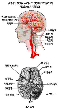 최신 온열요법(14)-정상체온 유지...치매 중풍예방