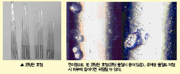 최신 온열요법(21)-'침'재질 유해 중금속 덩어리