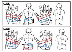 서금요법 이용 골반 교정법(3)