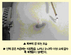 최신 온열요법(23)-신체에 직접 뜨는 뜸 매우 위험