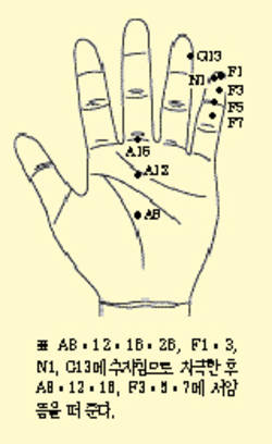 최신온열요법(34)-스트레스-냉증으로 위장기능 저하