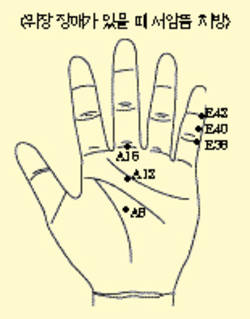 최신온열요법(36)-손 따뜻 상응부위 자극 교감신경 저하