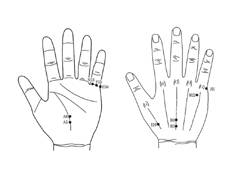 <월례학술>서암반지로 허리통증 사라져