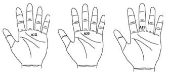 최신온열요법(53)-서암뜸 'A12'에 뜨면 위장운동 도움