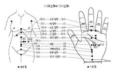 최신온열요법(69)-기모혈 서암뜸 자극시 금모혈 장부기능 조절