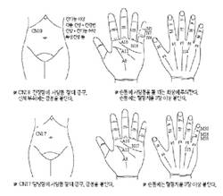최신온열요법(71)-기맥요혈 치방에 상응점, 기본방 자극 효과 우수