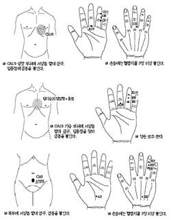 최신온열요법(72)-심장기능 조절하는 치방