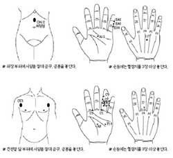 최신온열(74)-위장기능 조절하는 치방