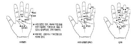 최신온열(77)-만성위장질환에 장기간 뜸뜨면 효과