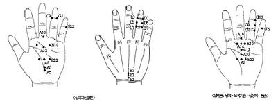 최신온열(79)-'서암뜸'자율신경과 혈류량 조절