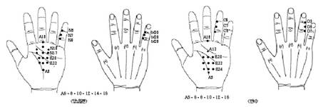 최신온열(82)-'발지압판' 변비에 효과