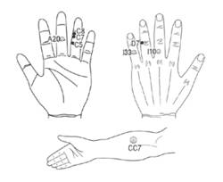 금봉기·마크봉 부착… 기침·인후염 해소