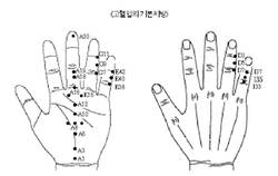 최신온열(87)-'서암뜸'음양맥상 조절돼 고혈압에 도움