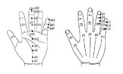 최신온열(88)-서암뜸으로 감기바이러스 제거