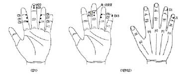 최신온열(89)-'서암뜸'면역력 증가‥감기·기관지염 완화