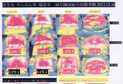 서금요법 비만관리·온열효과에 '최고'