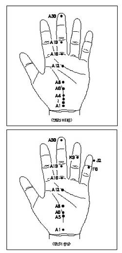 특상황토서암뜸으로 갱년기증상 완화