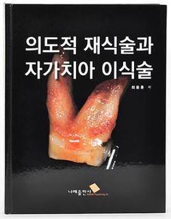 “의도적 재식술과 자가치아 이식술”…