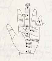 갑상선기능저하