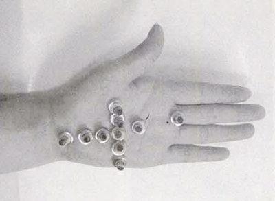 임산부의 아기가 거꾸로 있는 경우