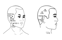 악관절 탈구