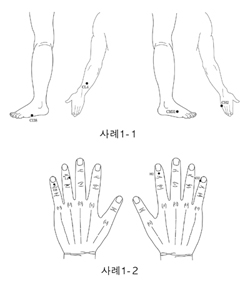 사례1-1, 1-2