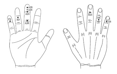 유소아 건강관리