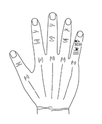 교통사고 후유증