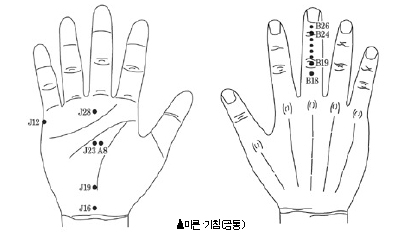 마른기침