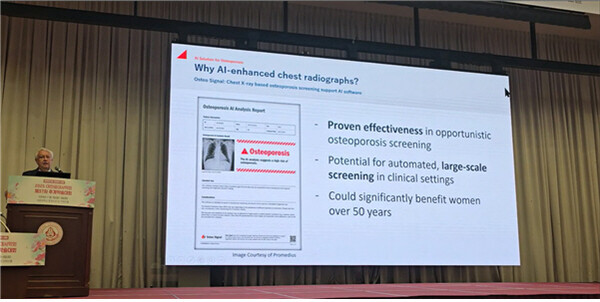 프로메디우스 과학자문위원 장 이브 교수, 대한골대사학회 초청 강연 성... - 뉴스 썸네일 이미지