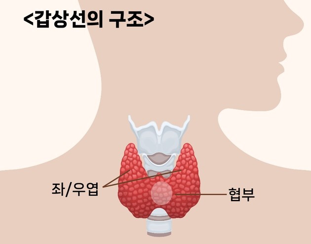 저위험 갑상선 협부암 환자,협부절제술도 안전하고 효과적
