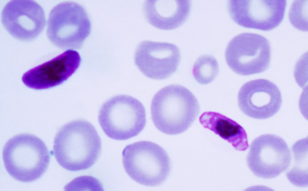 로슈진단, 헌혈 혈액 말라리아 선별 검사 '코바스 말라리아' 시약 출시