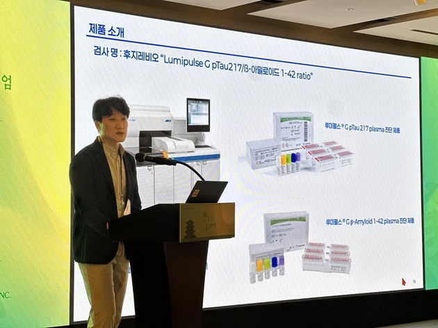 대웅바이오, 혈액 기반 알츠하이머 진단 도입… CNS 사업 경쟁력 강화