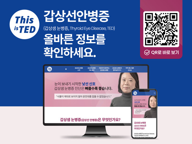 암젠코리아, 국내 최초 갑상선안병증 전문 웹사이트 개설