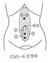 한일학술대회 임상사례] 뒷목 뻣뻣 목디스크 서금요법으로 완화